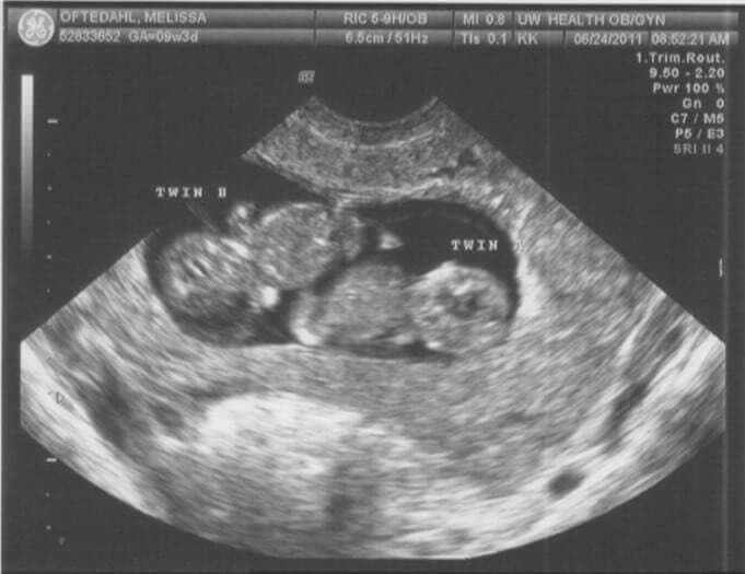 Would They Have Swiped Septuplets For Twins?