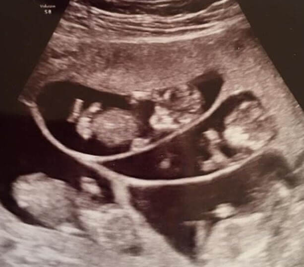 Exciting and Scary Times